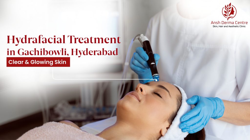 Hydrafacial Treatment in Gachibowli