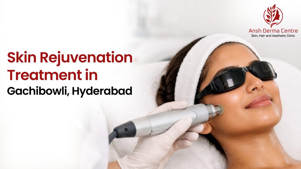 Skin Rejuvenation Treatment in Gachibowli