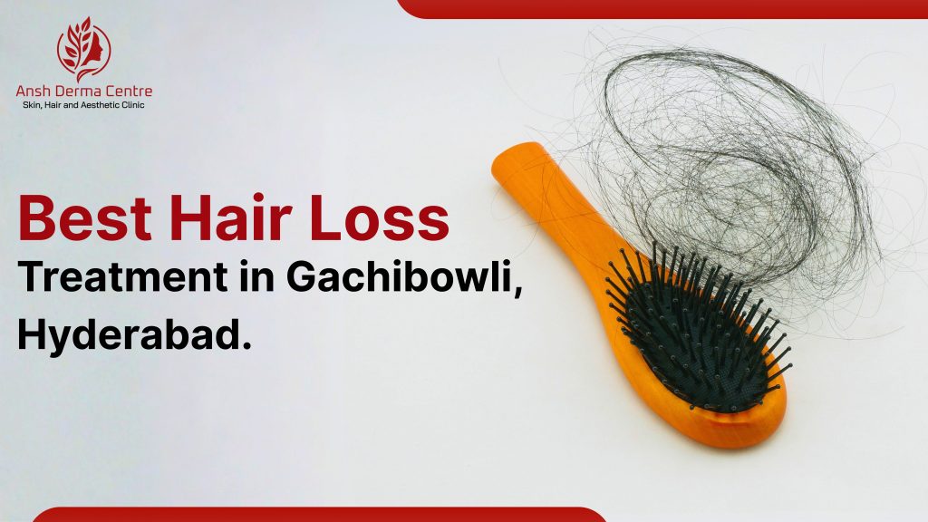 Best Hair Loss Treatment in Gachibowli