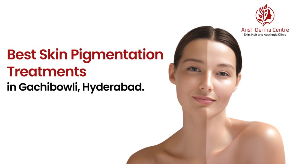 Best Skin Pigmentation Treatments in Gachibowli