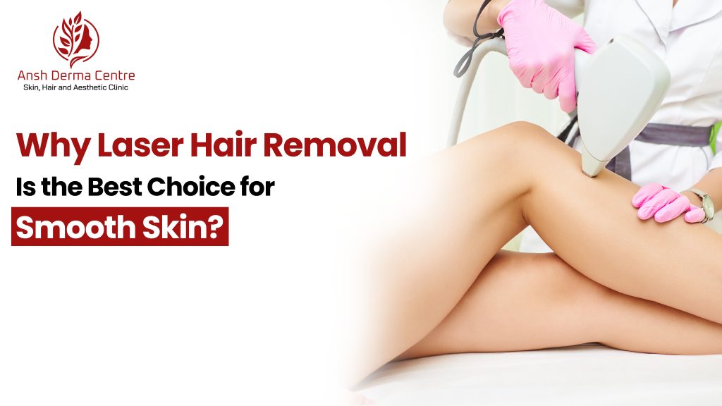 laser hair removal in Gachibowli