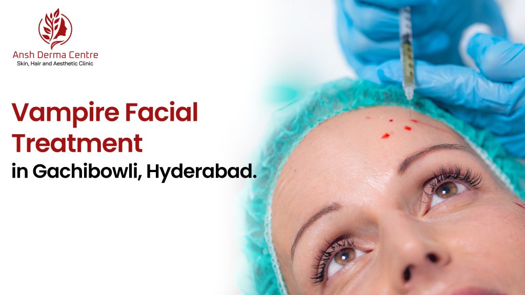 Vampire Facial Treatment in Gachibowli