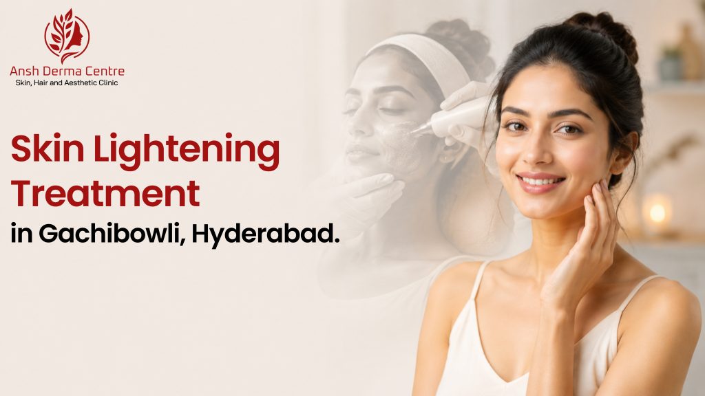 Skin Lightening Treatment In Gachibowli