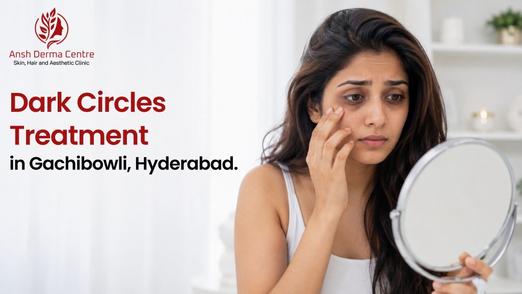 Dark Circles Treatment in Gachibowli