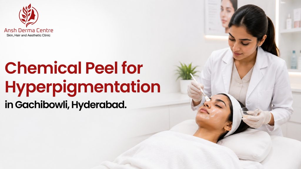 Chemical Peel for Hyperpigmentation in Gachibowli