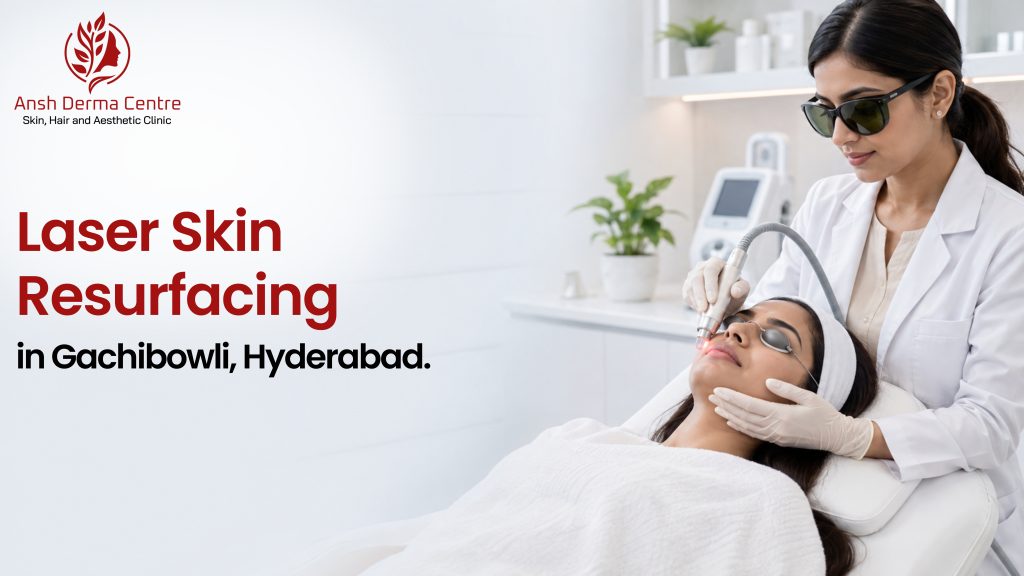 Laser Skin Resurfacing in Gachibowli