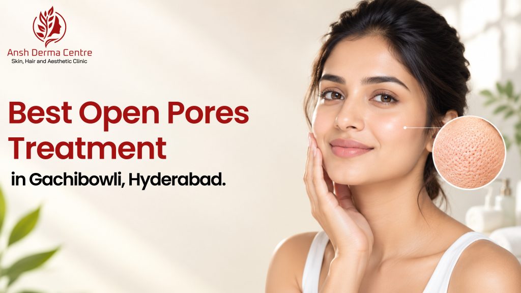 Best Open Pores Treatment in Gachibowli