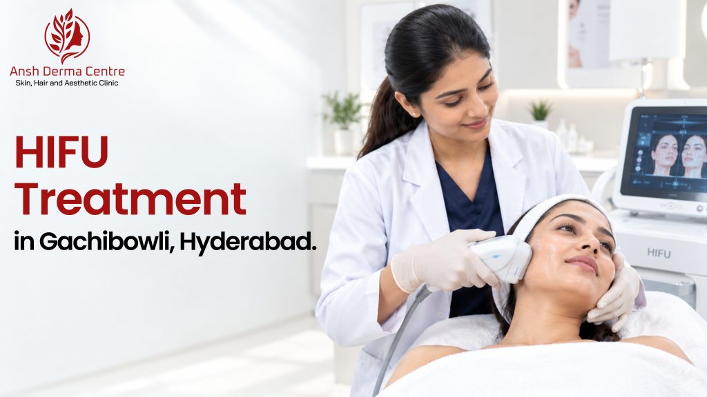 HIFU Treatment in Gachibowli